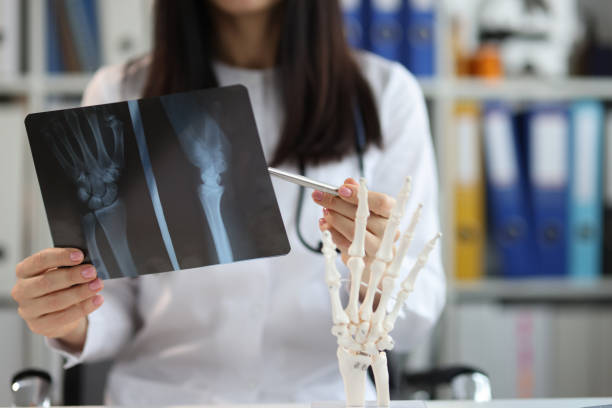 X ray image of elbows that belongs to a child showing a fracture on the left one. 