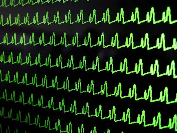 istock Train of pulses 139378484