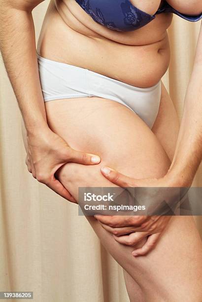 Woman Showing Cellulite On Right Thigh Stock Photo - Download Image Now - Abdomen, Adult, Beauty