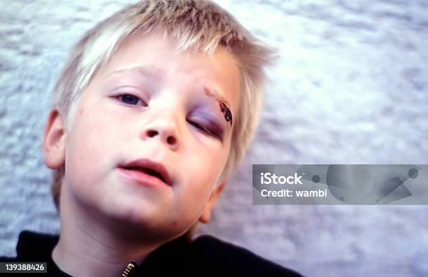 Injury01 - Fotografias de stock e mais imagens de Parque Infantil - Parque Infantil, Acidente - Conceito, Escorregar