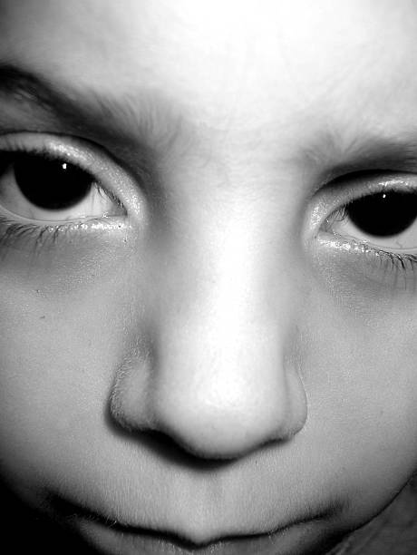 istock The Black Eye Child 139389105