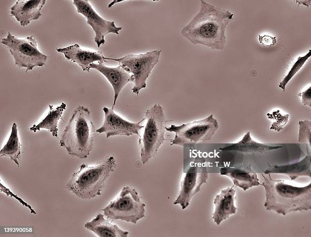 As Células Cancerígenas Na Cultura - Fotografias de stock e mais imagens de Célula HeLa - Célula HeLa, ADN, Abstrato