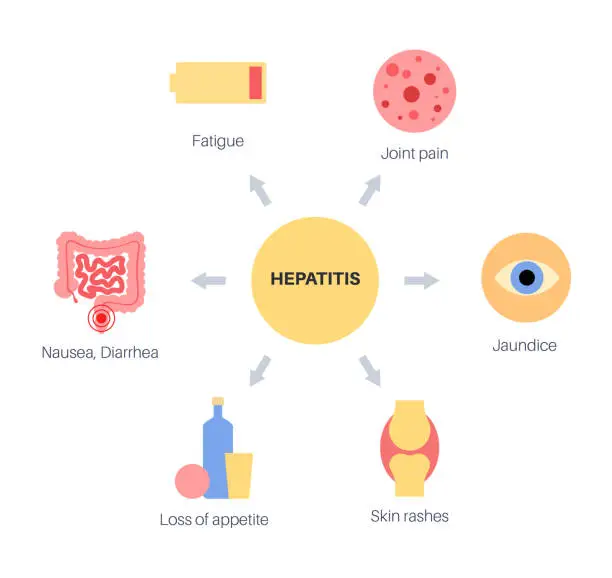 Vector illustration of Autoimmune hepatitis disease