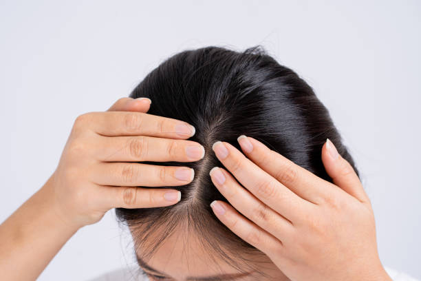 Wanita memijat kulit kepala. Terisolasi dengan latar belakang putih. foto stok. tips merawat rambut