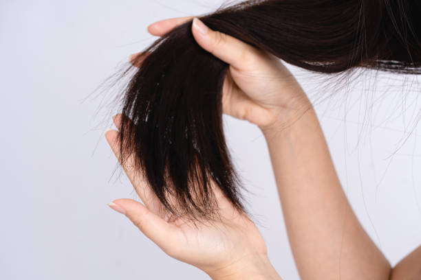 istock Close up hand holding black damaged hairs on a white background 1393932697
