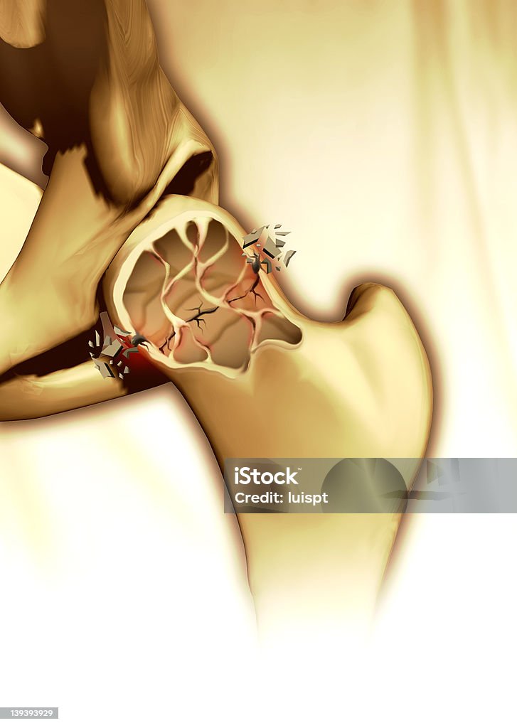 Breaking bone 3D and Photoshop Illustration Anatomy Stock Photo