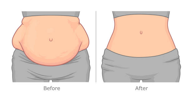 visceral fat makes