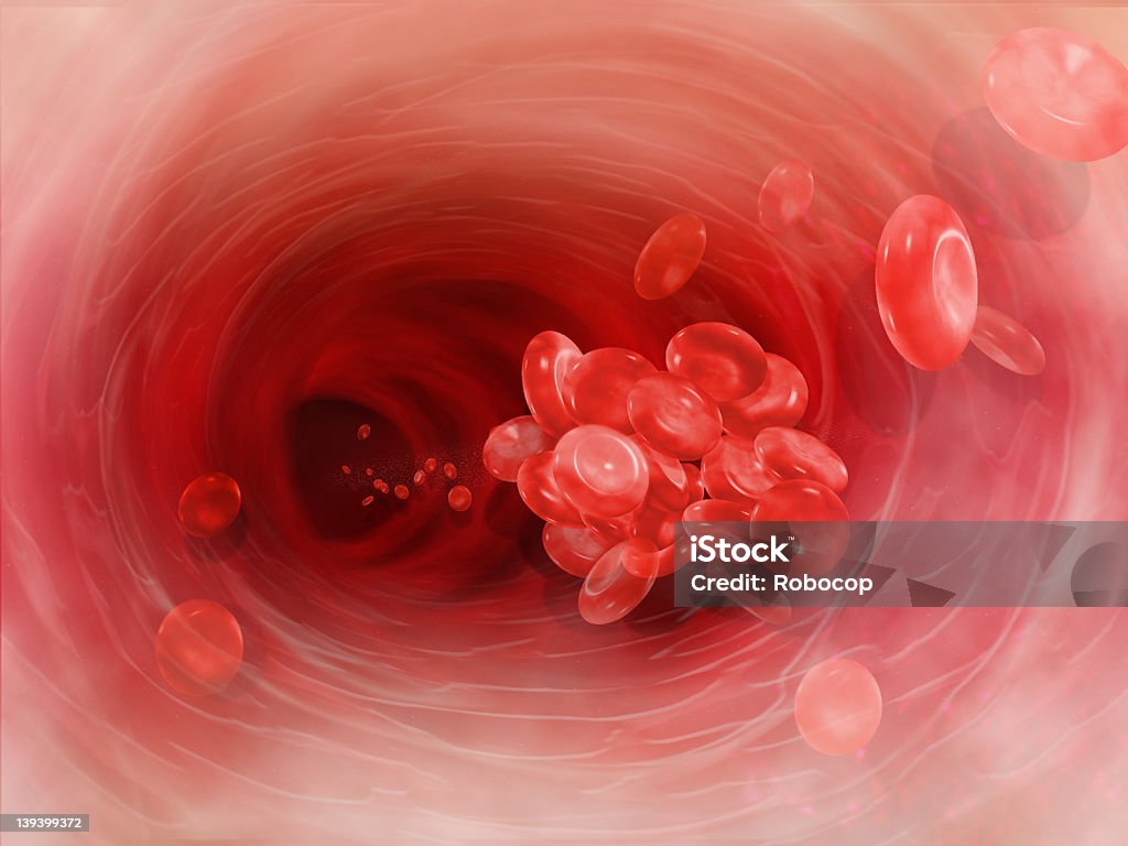 Blood Clot Cell Artery Blood Clot, Vein, Artery, Tunnel, Red Blood Cells, Internal Body, Blood Cell, Heart Blood Clot Stock Photo