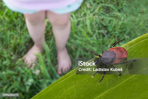 istock Bare child feet and deer tick on a grass playground. Ixodes ricinus 1394004111