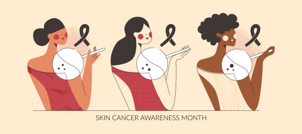 illustrazioni stock, clip art, cartoni animati e icone di tendenza di illustrazione vettoriale del mese di consapevolezza del cancro della pelle e del melanoma. donne diverse con voglia sulla spalla, malattie dermatologiche, screening del corpo, controllo dei problemi oncologici. controllo della prevenzione della persona, co - neo