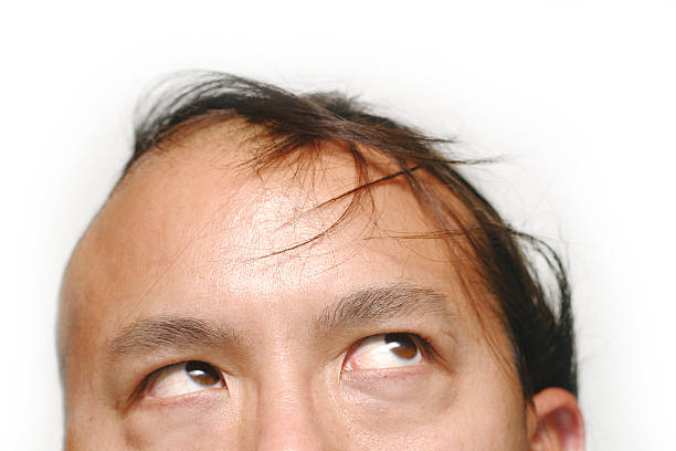 Combover from hell The hair, such as it is, is not cooperating. 100% white background. Harsh lighting on the forehead is intentional, adds to the mood. comb over stock pictures, royalty-free photos & images