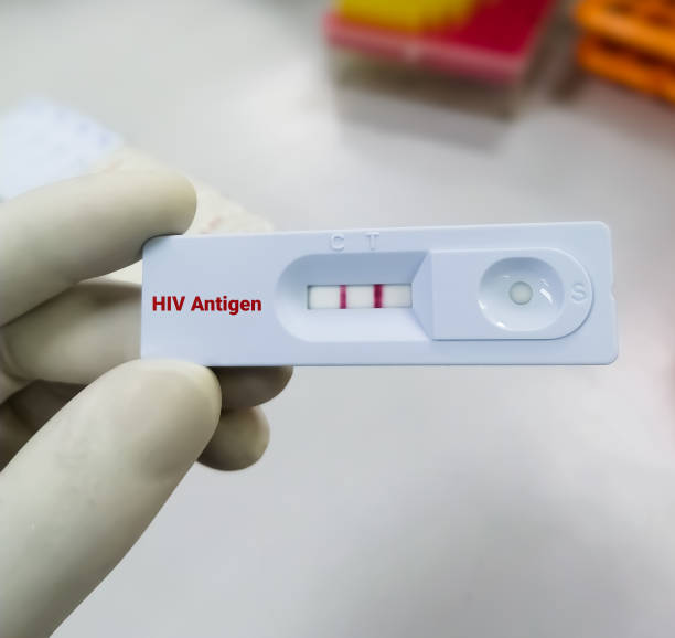 istock HIV antigen positive test result by using rapid test cassette 1394066750