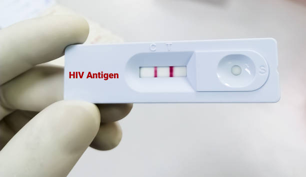 istock HIV antigen positive test result by using rapid test cassette 1394067315
