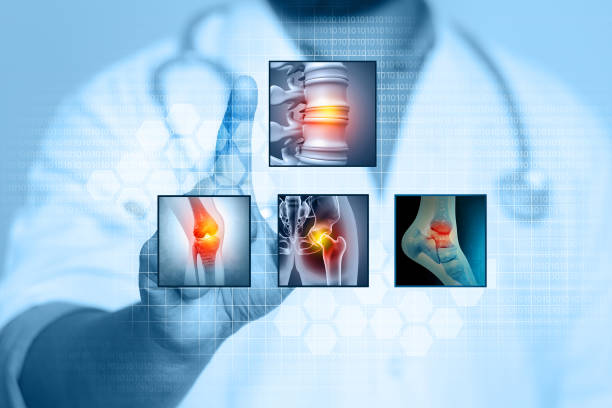 istock Doctor's hand shows lumbar intervertebral spine hernia. 3d illustration 1394185004
