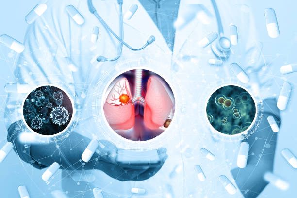 istock Virus and bacteria infected the Human lungs.lung disease.3d illustration 1394189978