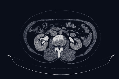image from CT of internal organs