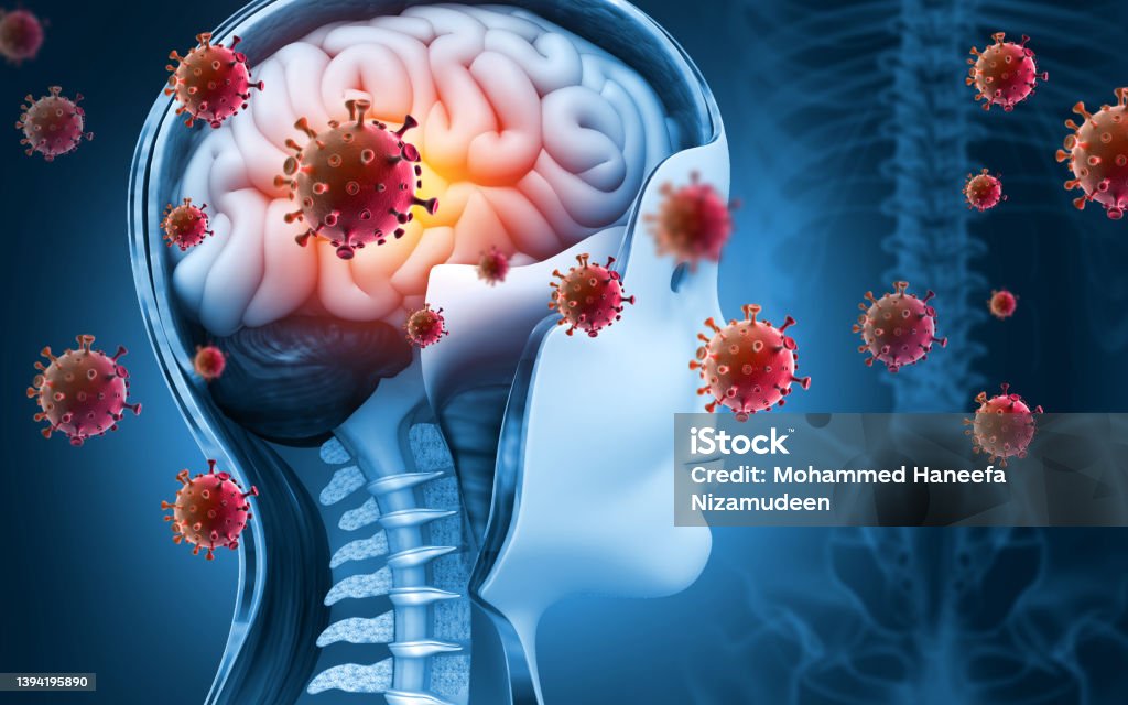 Brain viral infection, Viral meningitis and encephalitis. 3d illustration Meningitis Stock Photo