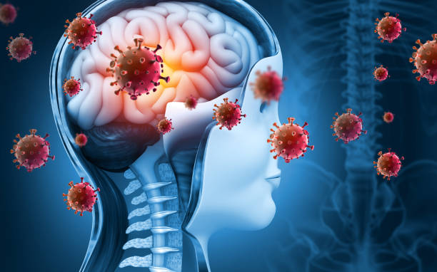 Brain viral infection, Viral meningitis and encephalitis. 3d illustration Brain viral infection, Viral meningitis and encephalitis. 3d illustration narcolepsy stock pictures, royalty-free photos & images