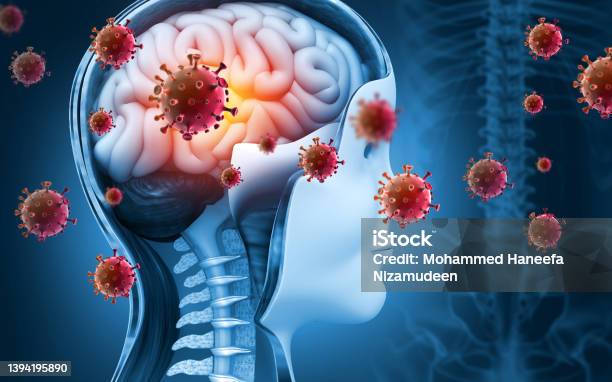 Brain Viral Infection Viral Meningitis And Encephalitis 3d Illustration Stock Photo - Download Image Now