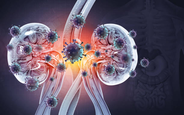 Kidney Disease