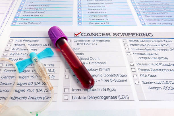 Blood test sample for Tumor markers test for diagnosis cancer Blood analysis with request form for screening of test for Malignancy oncology cancer cells investigation in patient. Blood test sample for Tumor markers test for diagnosis cancer cancer screening stock pictures, royalty-free photos & images