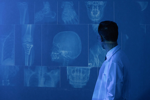 Radiologist examining and pointing at patient X-ray results and discussion with colleagues in hospital.