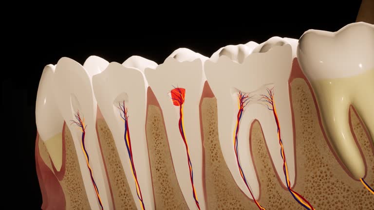3,479 Dental Filling Stock Videos and Royalty-Free Footage - iStock | Tooth colored dental filling, Gold dental filling, Dental filling materials 3,479 Dental Filling Stock Videos and Royalty-Free Footage - iStock | Tooth colored dental filling, Gold dental filling, Dental filling materials