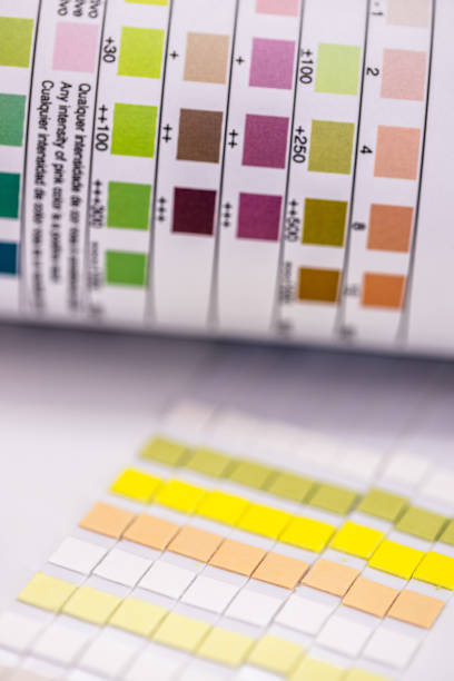 istock Urinalysis reagent strip used to control ketosis and other 9 parameters, vial with strips 1394473914