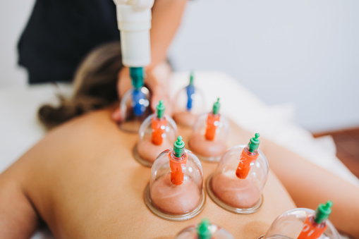 Suction cups placed on a female patient's back, by a massage therapist. Medical spa massage center. High quality photo. Horizontal. Health care.