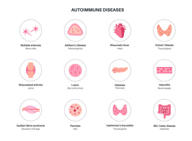 Autoimmune disorders diseases Autoimmune disorders diseases, set with icons of symptoms. Illness when the immune system attacks joints, blood, skin, internal organs. Medical poster for clinic or education flat vector illustration tissue anatomy stock illustrations