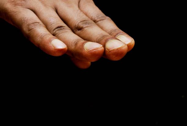 534 Spoon Nail Stock Photos, Pictures & Royalty-Free Images - iStock 534 Spoon Nail Stock Photos, Pictures & Royalty-Free Images - iStock