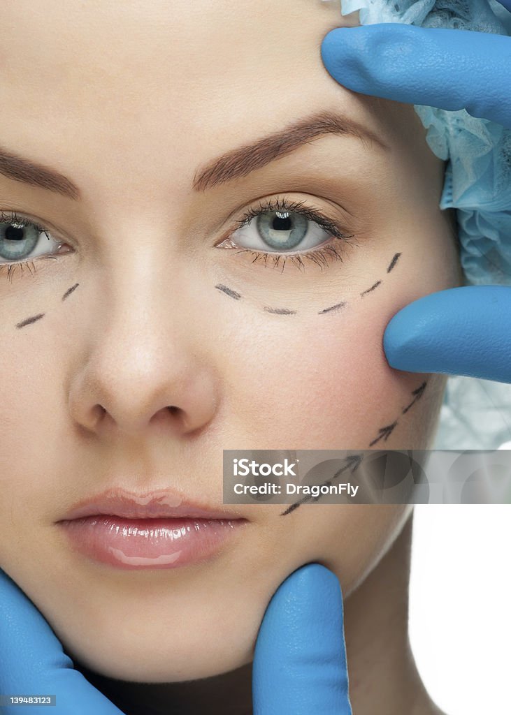Rostro femenino antes de la operación de cirugía plástica - Foto de stock de Adulto libre de derechos