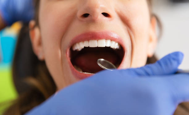 istock Woman Getting Her Dental Check Up 1394841447
