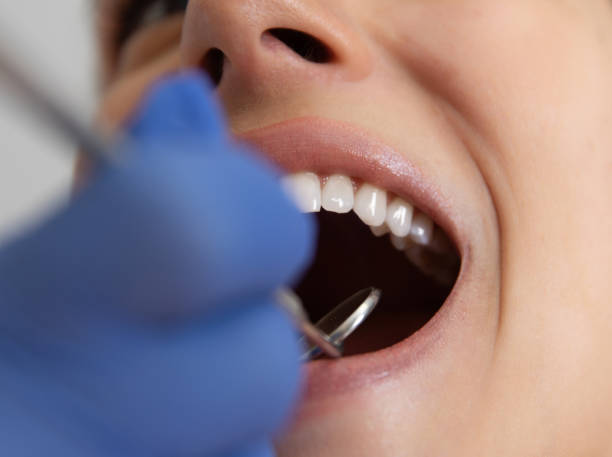 istock Closeup on Dental Check Up 1394841513