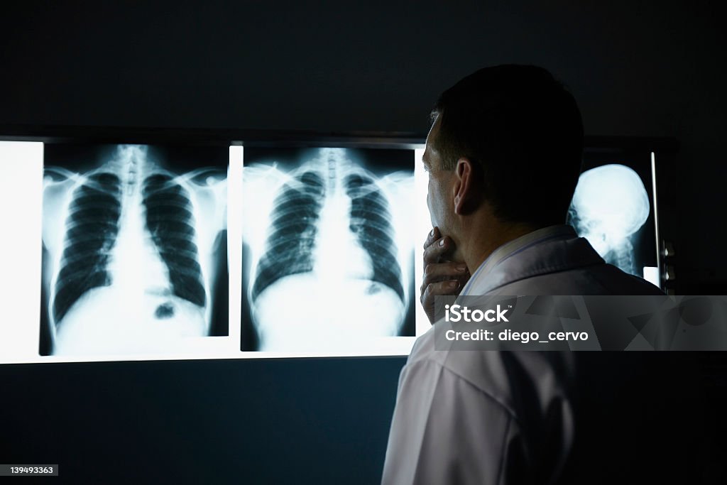 Médico trabaja en un hospital durante un examen de rayos x - Foto de stock de Cáncer - Tumor libre de derechos