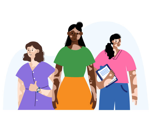 Vitiligo woman group Vitiligo world day, people with pale pigmentation. Love your skin, body positive poster with happy international female cartoon characters. White spots on the face and body flat vector illustration vitiligo stock illustrations