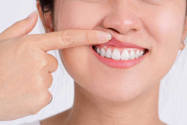 Woman showing her upper gums with her finger, an expression of pain. Dental care and toothache. Woman showing her upper gums with her finger, an expression of pain. Dental care and toothache. abscess stock pictures, royalty-free photos & images