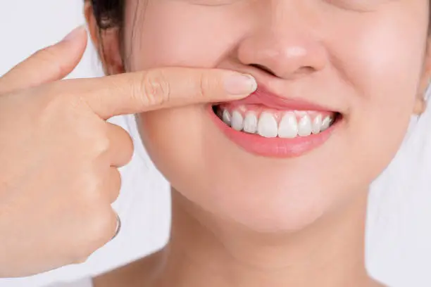 Photo of Woman showing her upper gums with her finger, an expression of pain. Dental care and toothache.