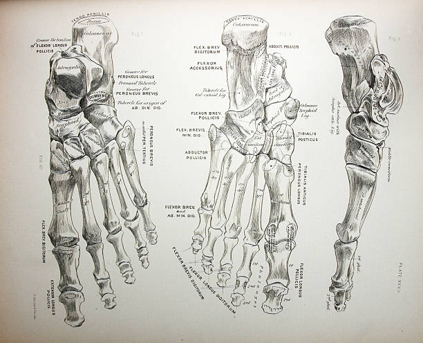 의료 일러스트레이션 뼈 풋 - bunion bunions human foot podiatry stock illustrations