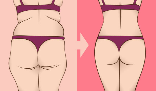 illustrations, cliparts, dessins animés et icônes de le corps d’une femme avant et après la perte de poids en sous-vêtements. - body women beauty slim