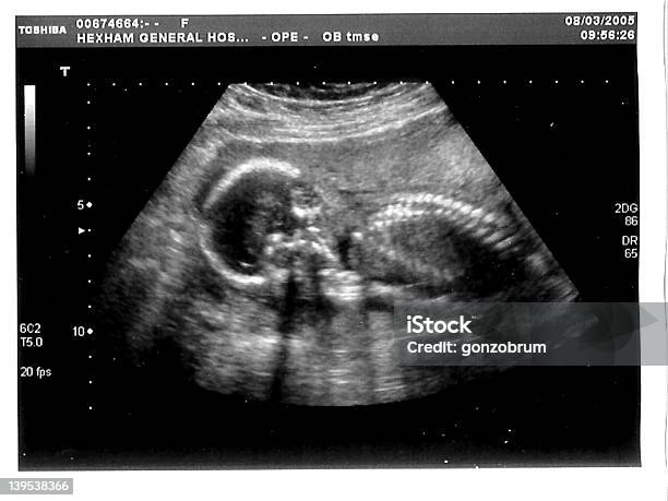 Foto de Meu Babys 19 Semana Scan e mais fotos de stock de Cabeça Humana - Cabeça Humana, Começo, Equipamento médico