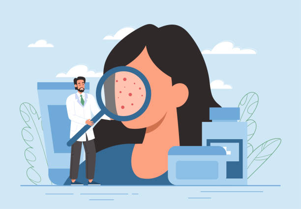 Skin diseases concept Skin diseases concept. Man with magnifying glass analyzes pimples and rashes on face of young girl. Cosmetic procedures, symptoms of diseases and diagnosis metaphor. Cartoon flat vector illustration dermatologist stock illustrations
