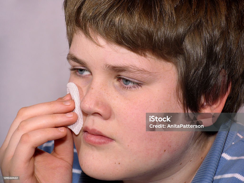 teen Akne - Lizenzfrei Akne Stock-Foto