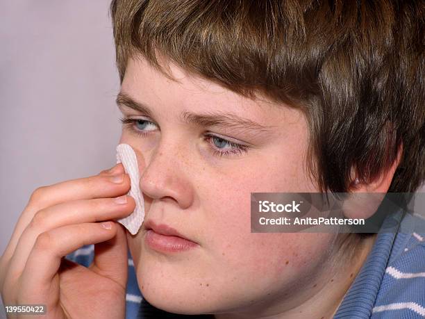 Foto de Acne Adolescente e mais fotos de stock de Acne - Acne, Adolescente, Adulto