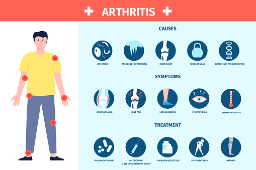 Arthritis infographic. Inflammation and care, symptoms and treatment. Healthcare poster with human and pain dots, recent vector hospital banner. Illustration of arthritis inflammation and pain