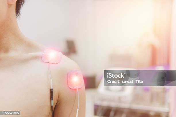 Tens Electrode Pads Prepare For Treatment On Shoulder Pain Stock Photo - Download Image Now