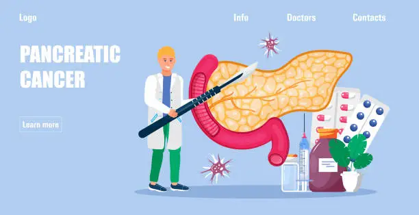 Vector illustration of Pancreatitis concept vector for medical website, app. Pancreas doctors examine. Oncologist surgeon performs an operation