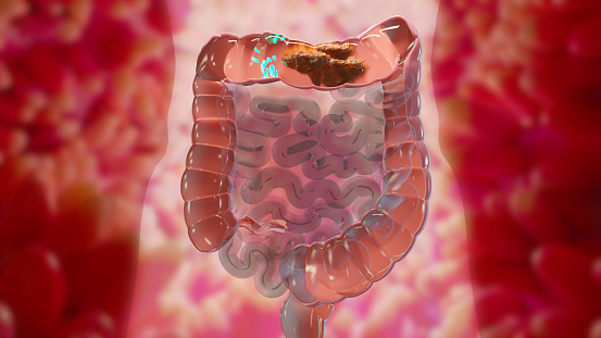 3d illustration of human digestive system anatomy, concept of the intestine,  laxative, traitement of constipation, 3d render