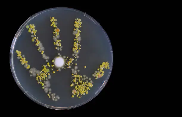 Germs on hands: colonies of bacteria and fungi in the hand of a child after playing outside. Concept of hand hygiene