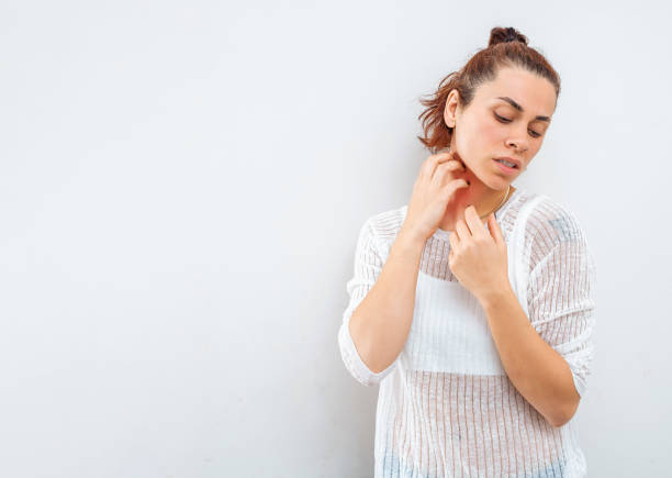 Woman scratching her neck due to allergies stock photo